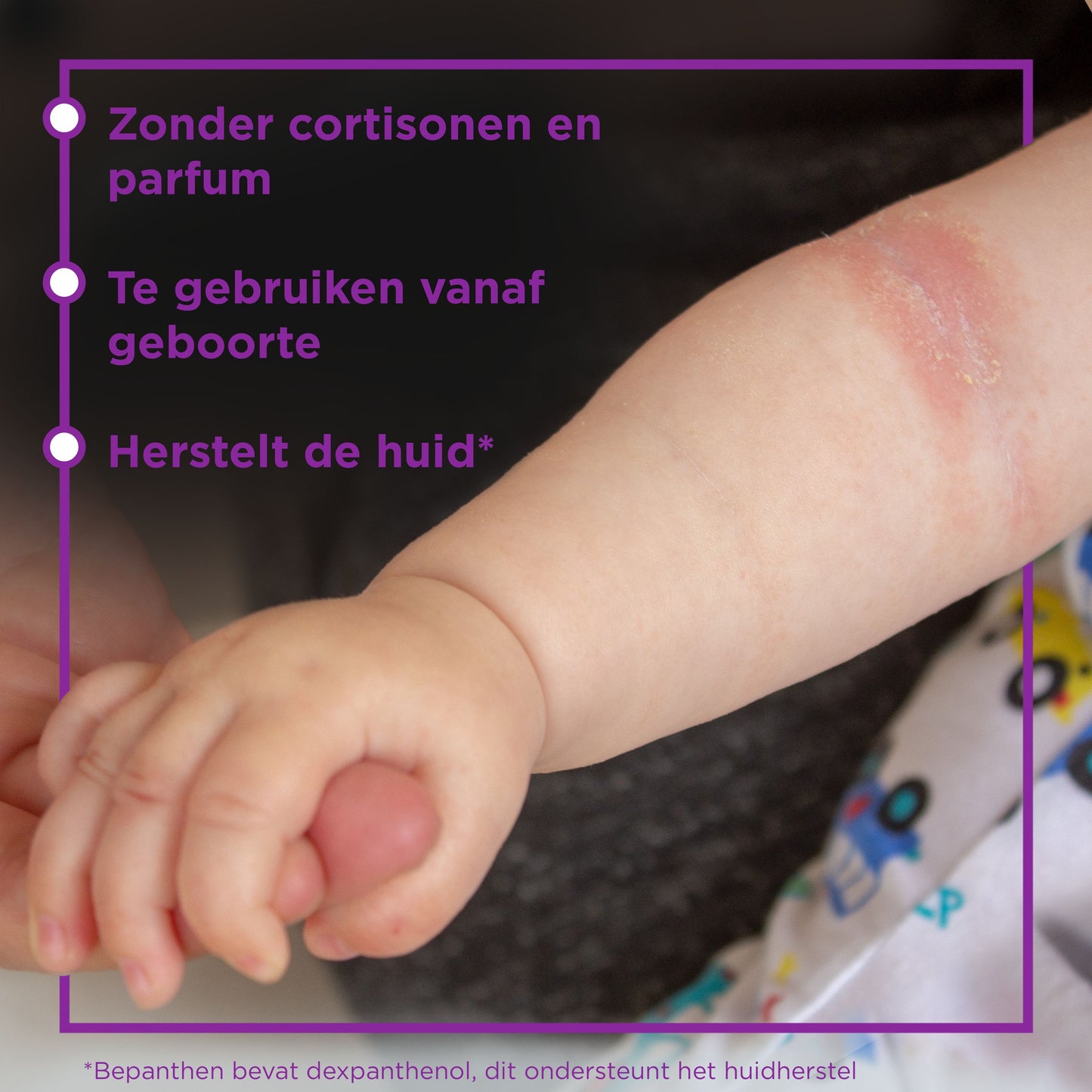 Bepanthen Eczeem baby creme 20 Gram