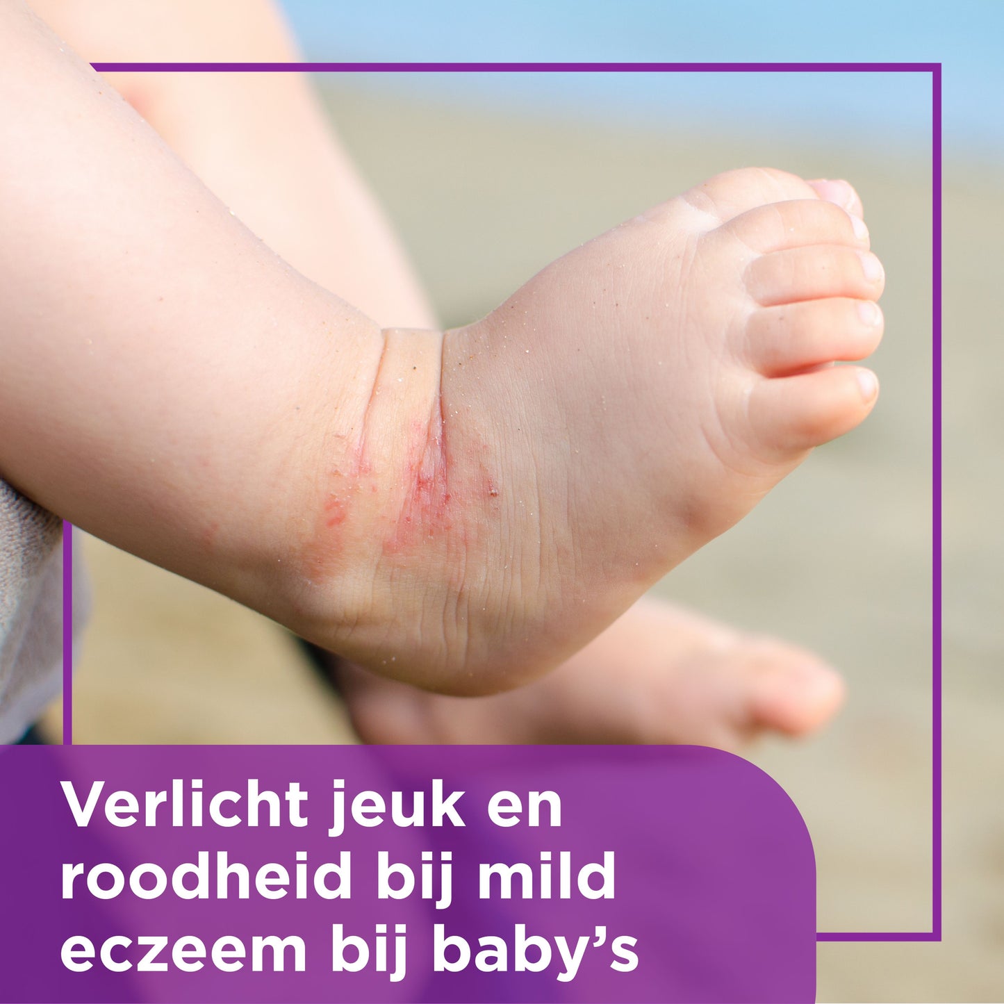 Bepanthen Eczeem baby creme 20 Gram