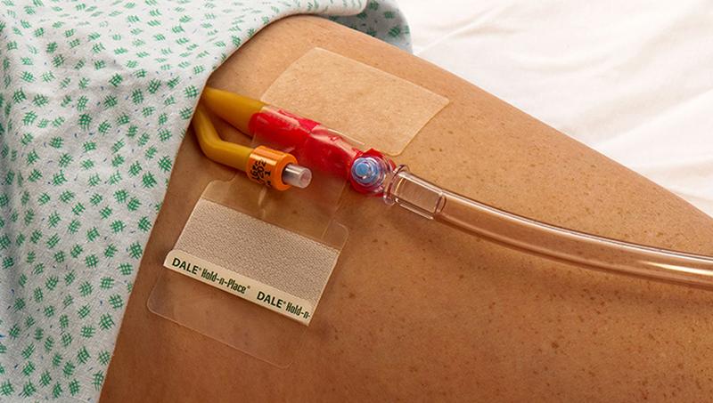 Dale Katheter fixatiepleister 1 Stuks