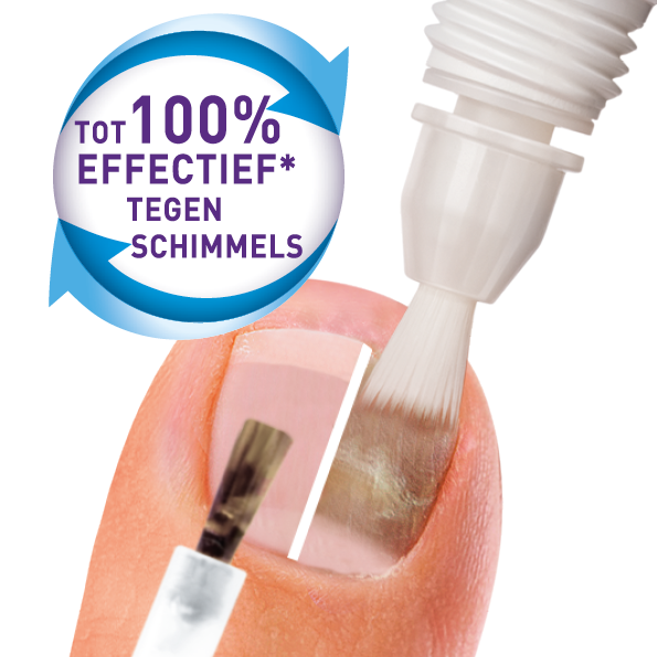 Mycosan Kalknagel behandel & camoufleer 1 Set